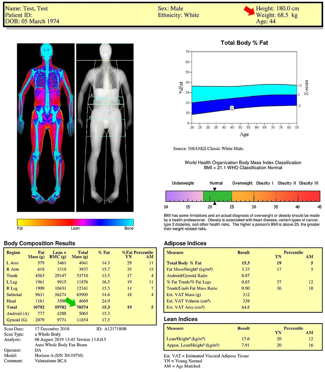 The WELL at Sac State on X: 😁 Don't forget we offer Body Composition  Assessments at The WELL. . ⚖️ A body composition assessment will determine  body fat percentage through use of